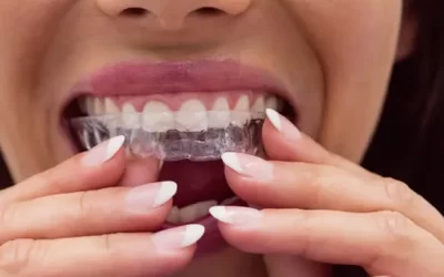 Invisalign Savannah: Clear Aligner Therapy for Discreet Orthodontic Correction